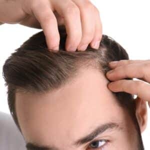 Hair Transplant DHI Package