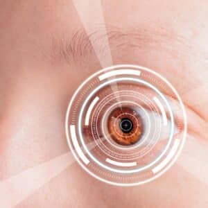 Eye Laser PRK Wavefront