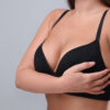 Breast Augmentation Mammoplasty