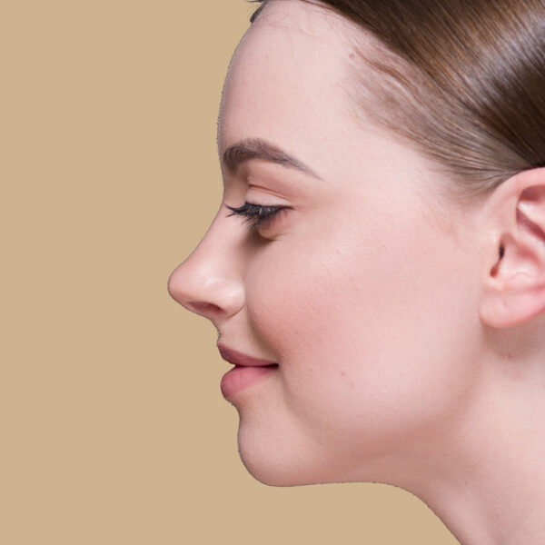 Rhinoplasty nose job