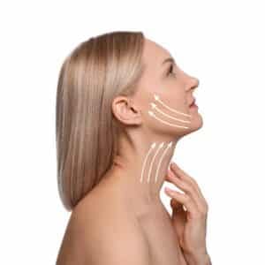 Total Face Lift Package