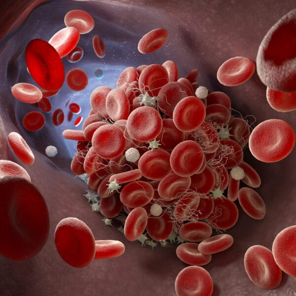 Medical Center Assistance Hempphilia Treatment