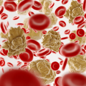 Medical Center Assistance Multiple Myeloma Treatment
