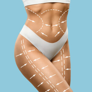 Medical CEnter Assistance Abdominoplaty