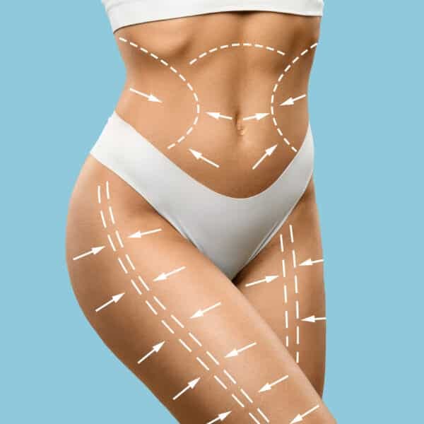 Medical CEnter Assistance Abdominoplaty