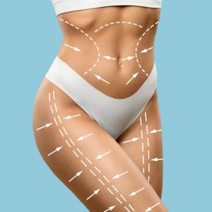 Medical CEnter Assistance Abdominoplaty